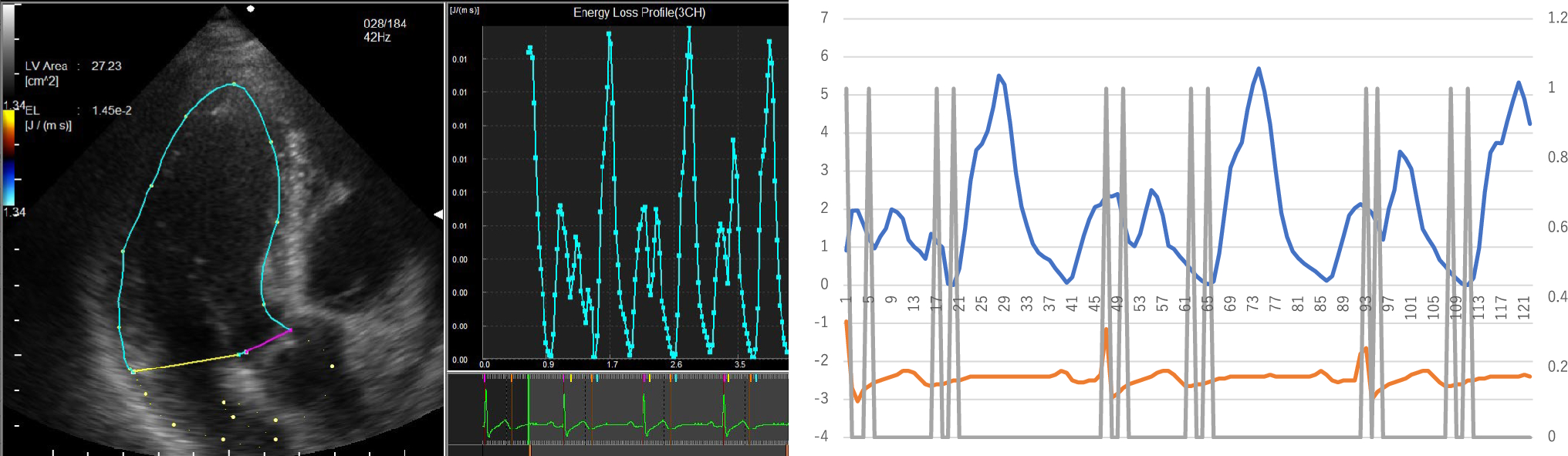 Reproducibility of the systolic and diastolic energy loss of the left ventricle in vector flow mapping