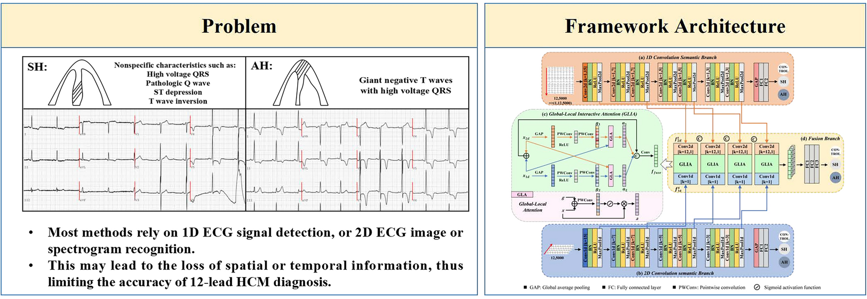 Optimized multi-stage network with multi-dimensional spatiotemporal interactions for septal and apical hypertrophic cardiomyopathy classification using 12-lead ECGs