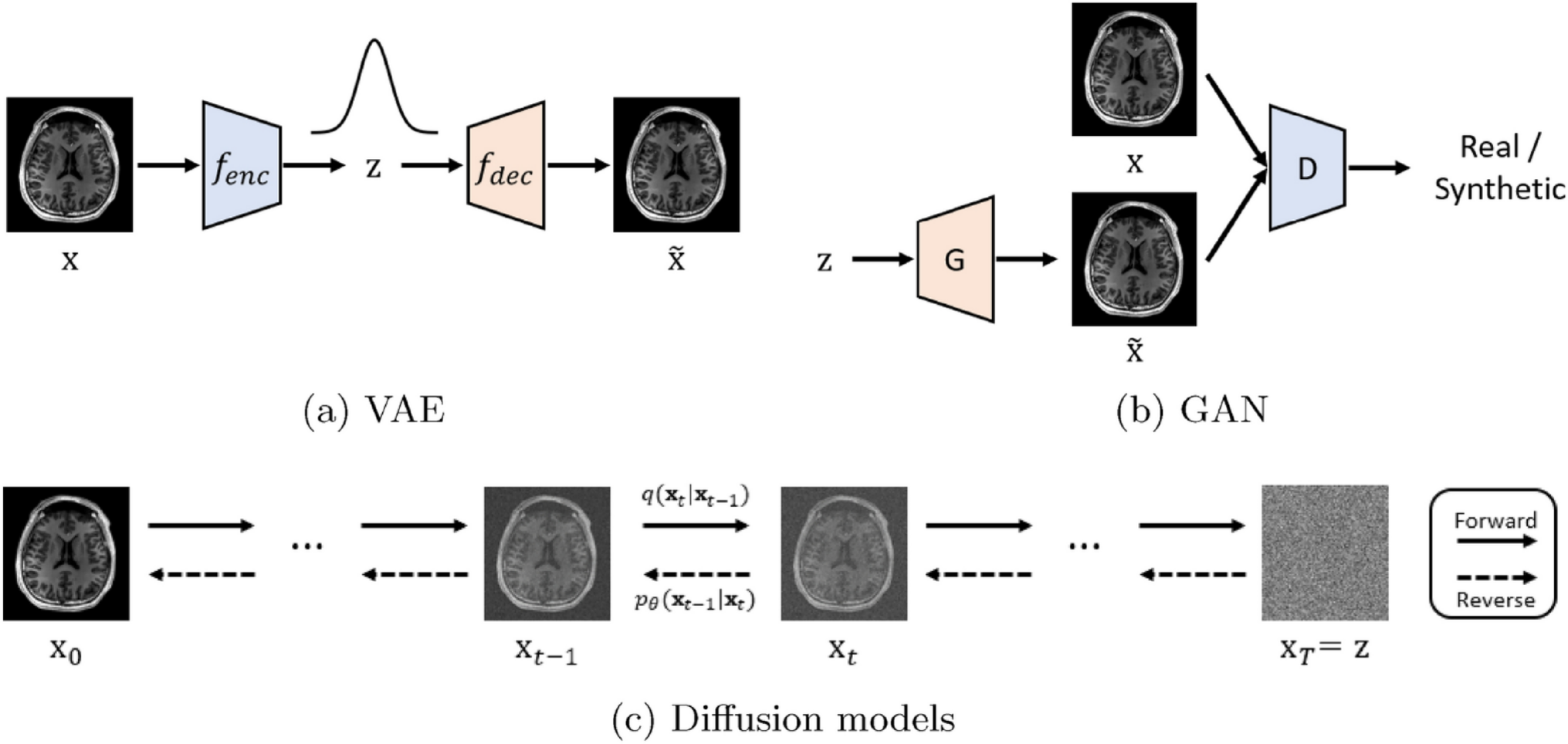 Survey on sampling conditioned brain images and imaging measures with generative models