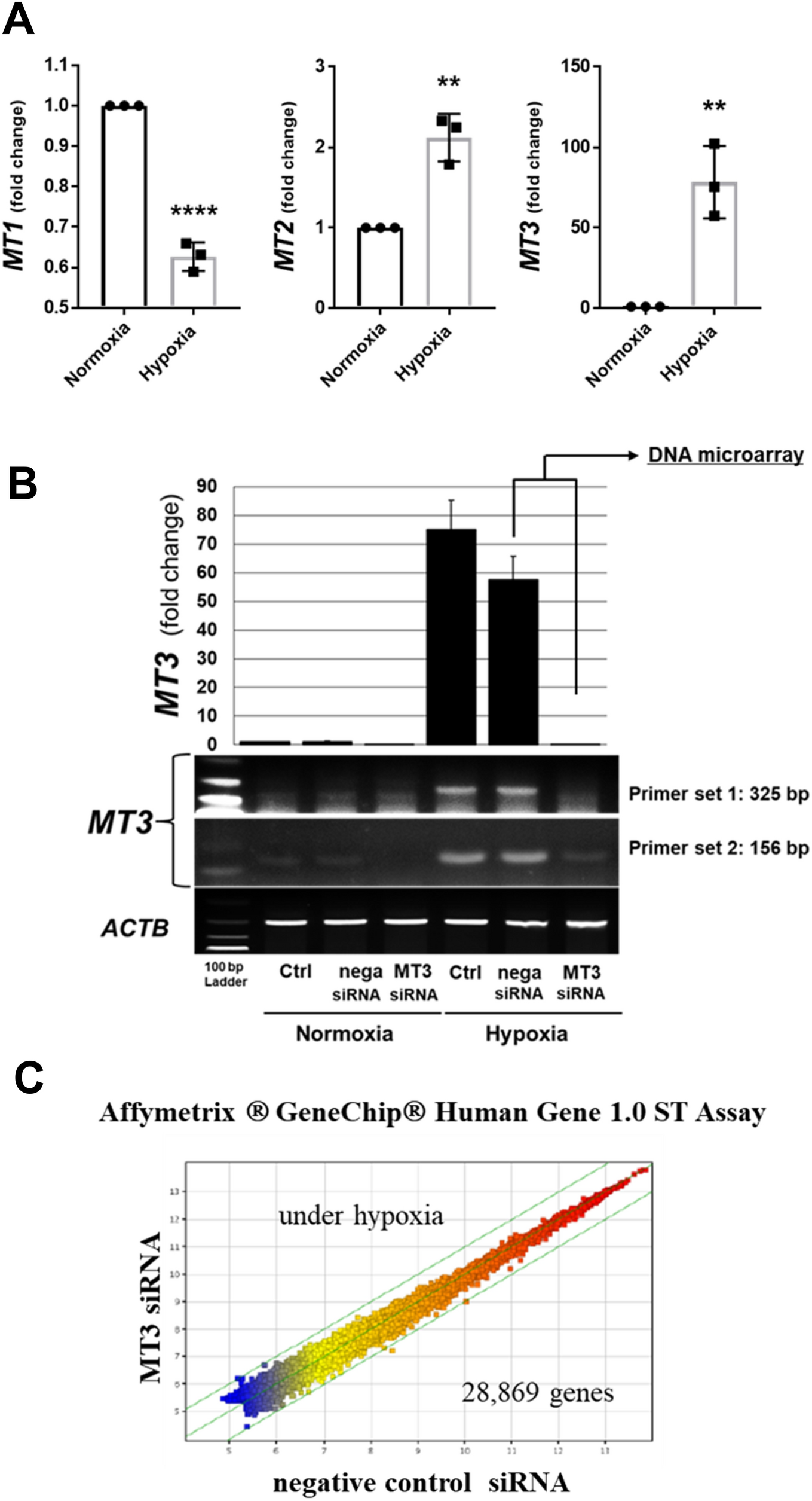 Role of metallothionein 3 in diabetic nephropathy via interplay with HIF-1α