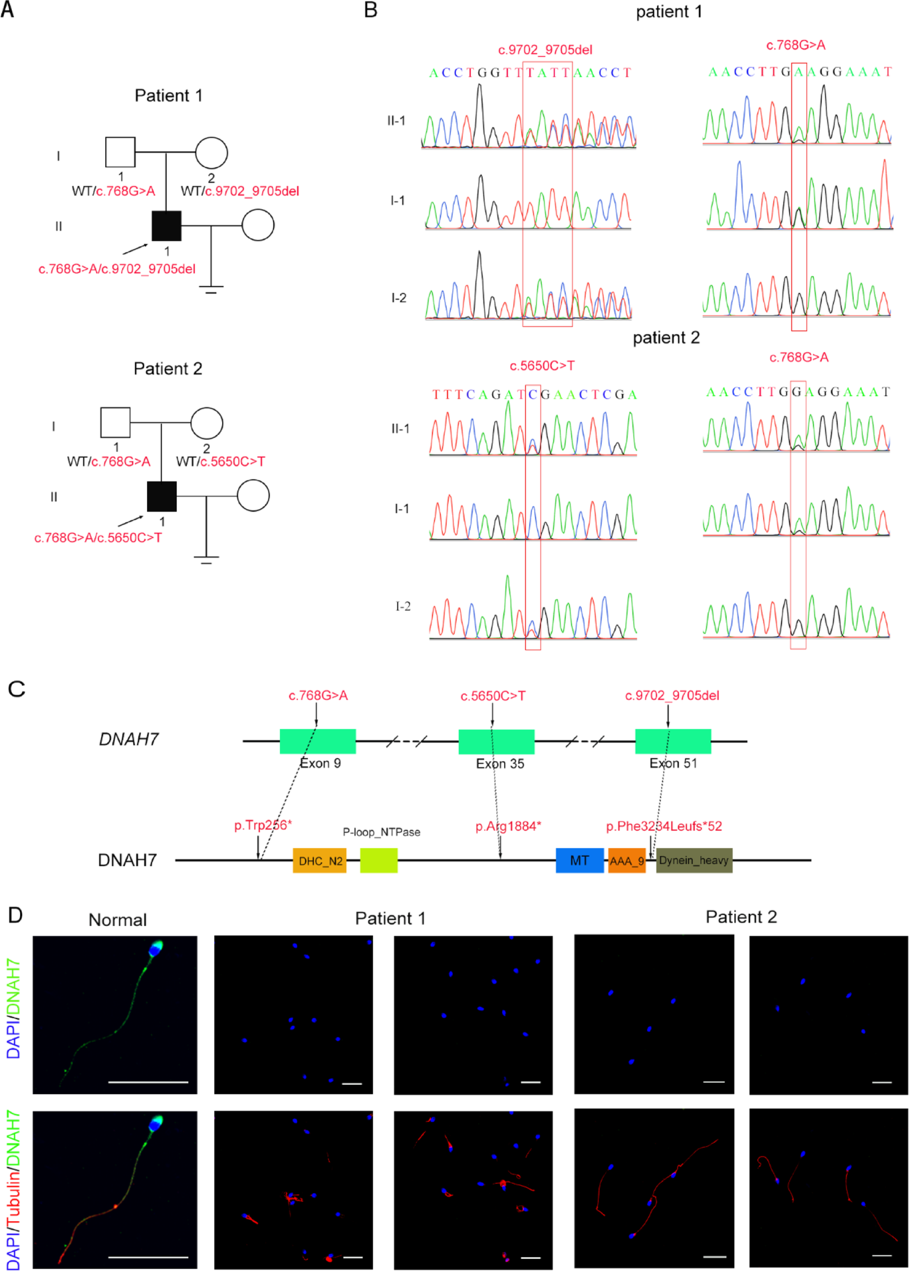 Biallelic loss-of-function variants of  cause male infertility associated with asthenozoospermia in humans
