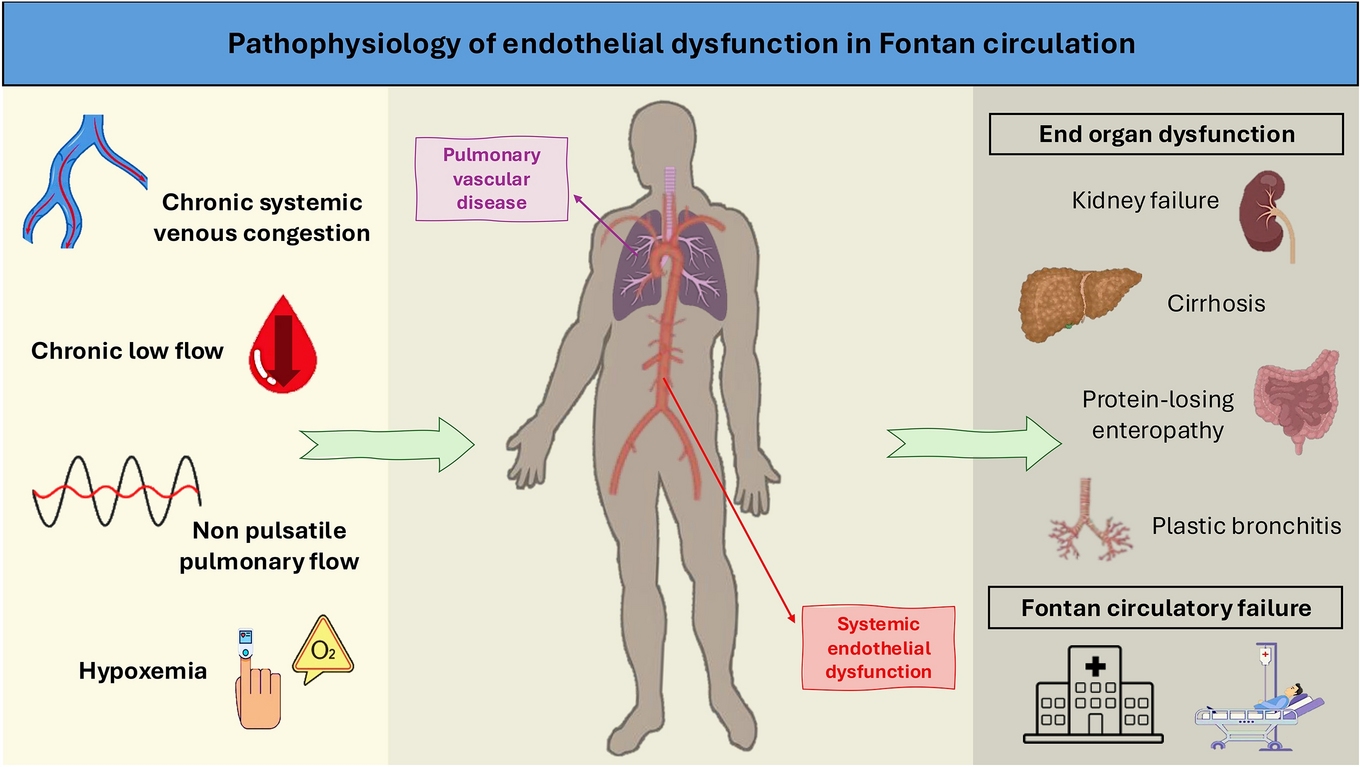 Pathophysiology of endothelial dysfunction in Fontan circulation: from bench to bedside and back again