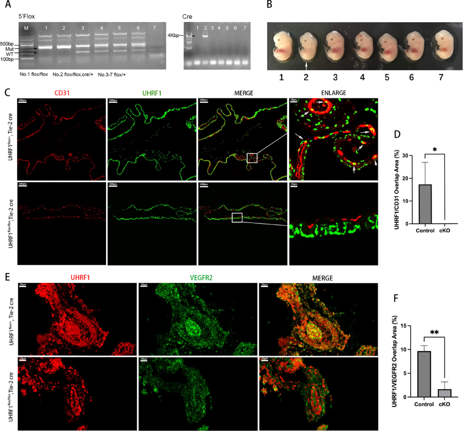 UHRF1 in endothelial cells is essential for angiogenesis and associated with the activation of pro-angiogenic signaling pathways and expression of endothelial genes
