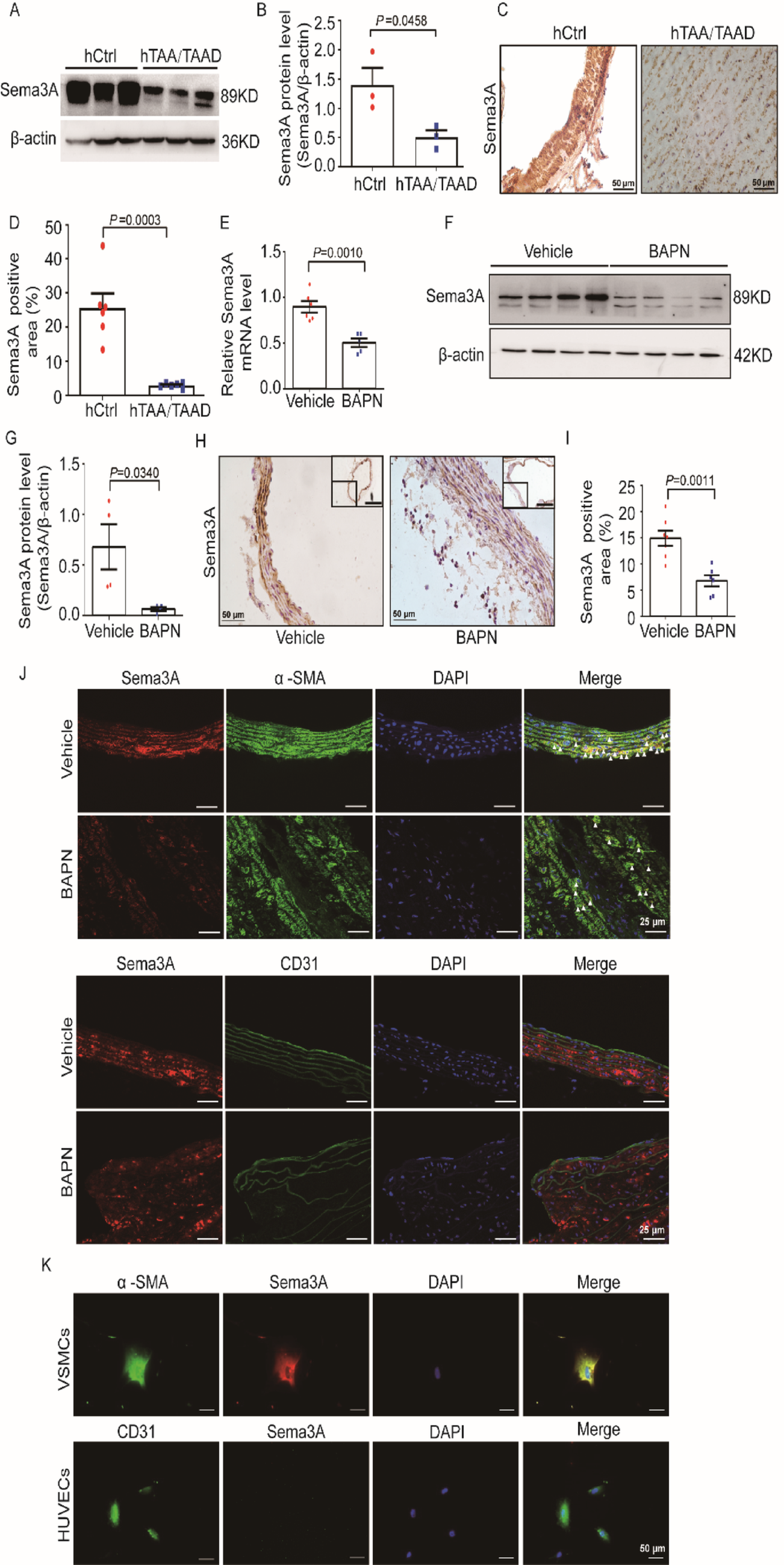 Semaphorin 3A protects against thoracic aortic aneurysm dissection by suppressing aortic angiogenesis