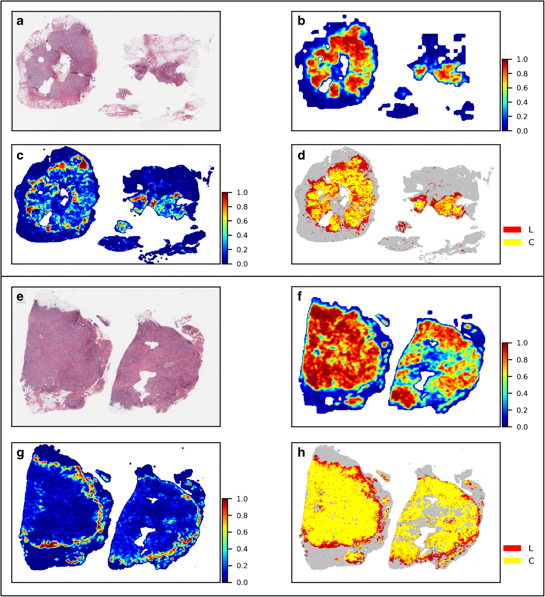 Characterizing Immune Responses in Whole Slide Images of Cancer With Digital Pathology and Pathomics