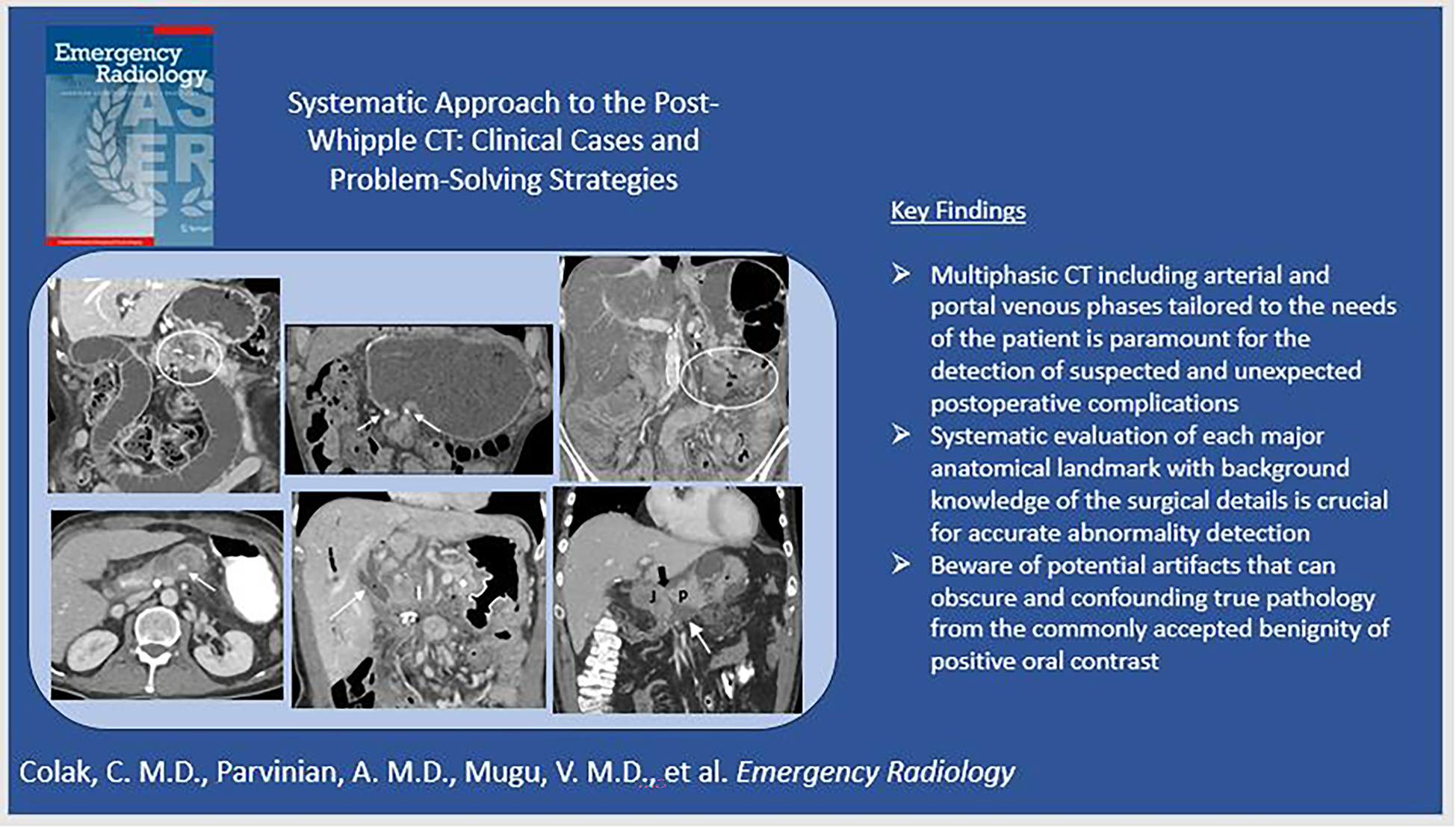 Systematic approach to the post-Whipple CT: clinical cases and problem-solving strategies
