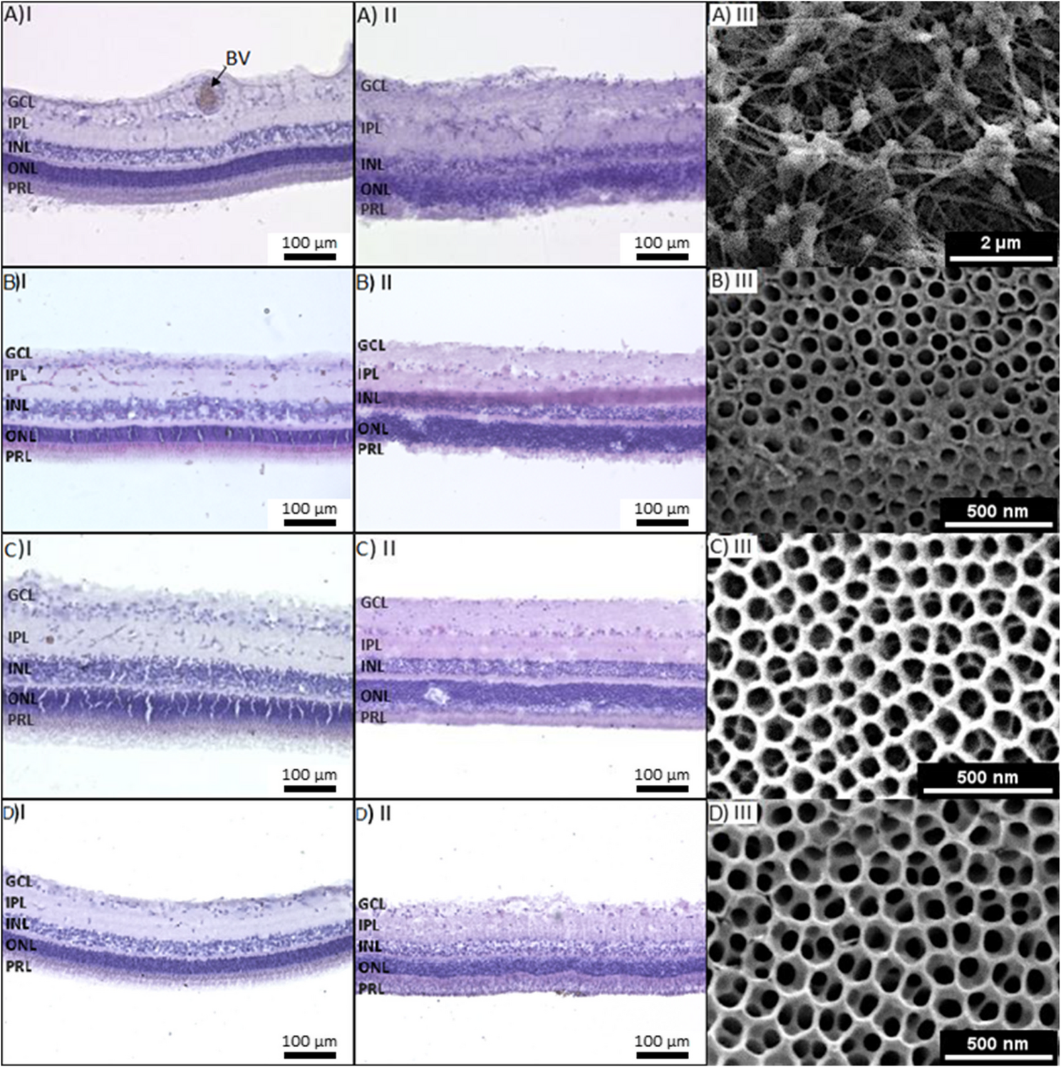 Organotypic Culture of Adult Vascularized Porcine Retina Explants In Vitro on Nanotube Scaffolds