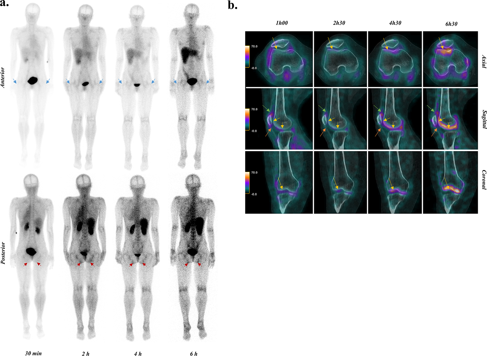 [99mTc]Tc-NTP 15 − 5, a new proteoglycan tracer for functional imaging of joint cartilage: phase I (CARSPECT)