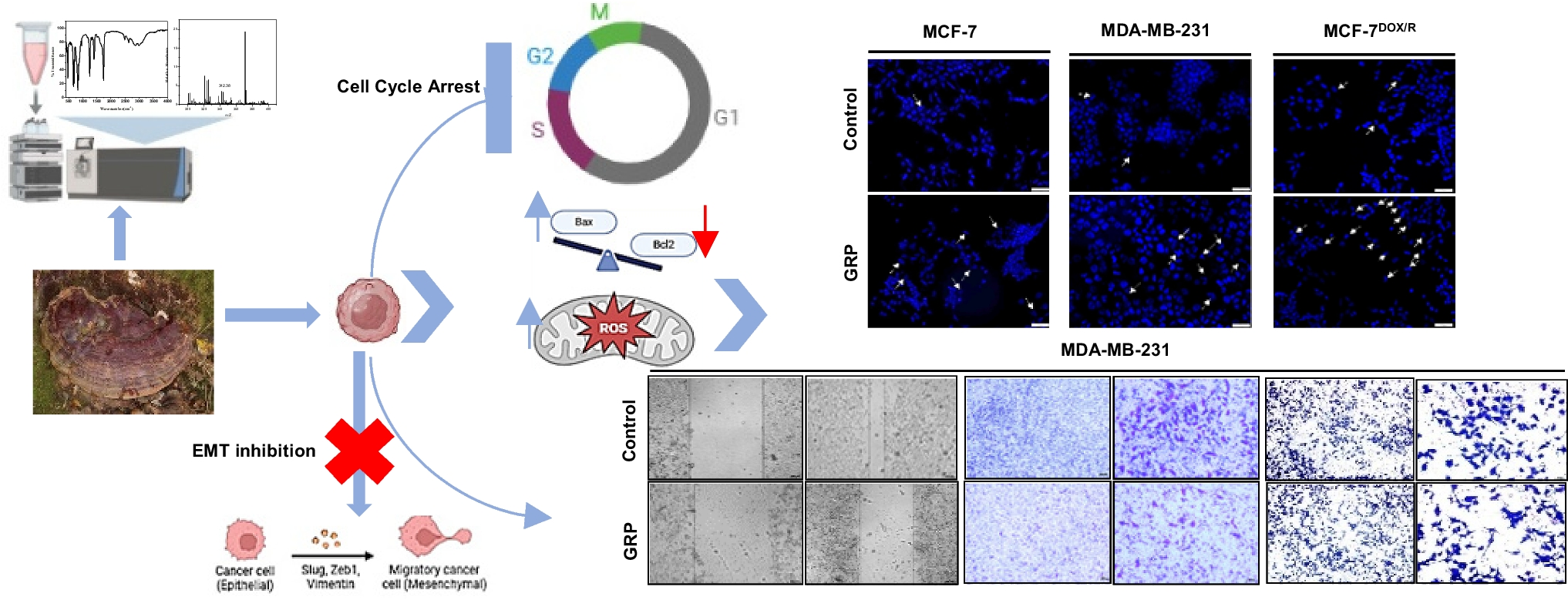 Polysaccharide Extract of  Restricts Breast Cancer Progression  by Intervening in Epithelial–Mesenchymal Transition and Cancer Stemness