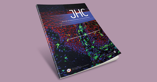 SPM Receptor Expression and Localization in Irradiated Salivary Glands