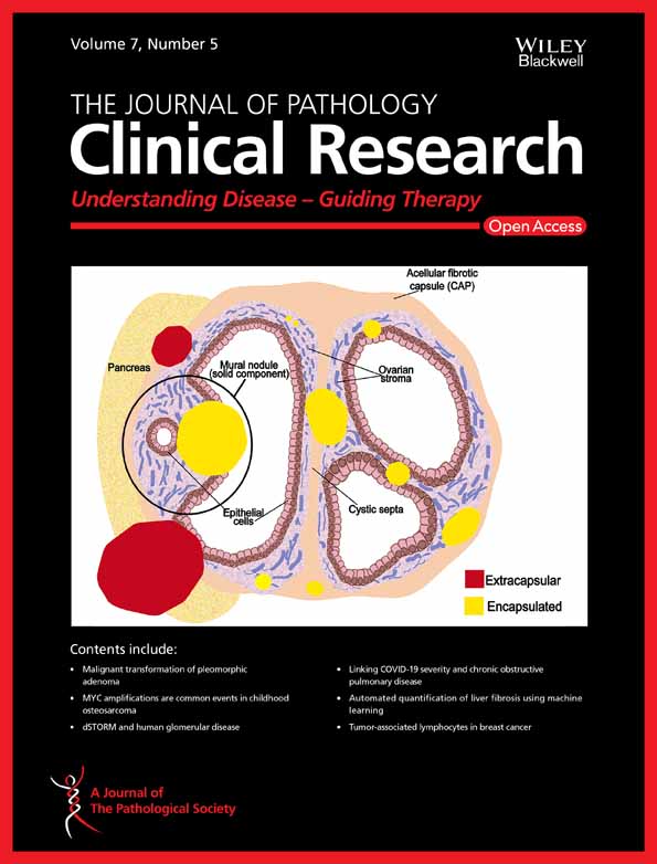 Preoperative systemic chemotherapy alters the histopathological growth patterns of colorectal liver metastases