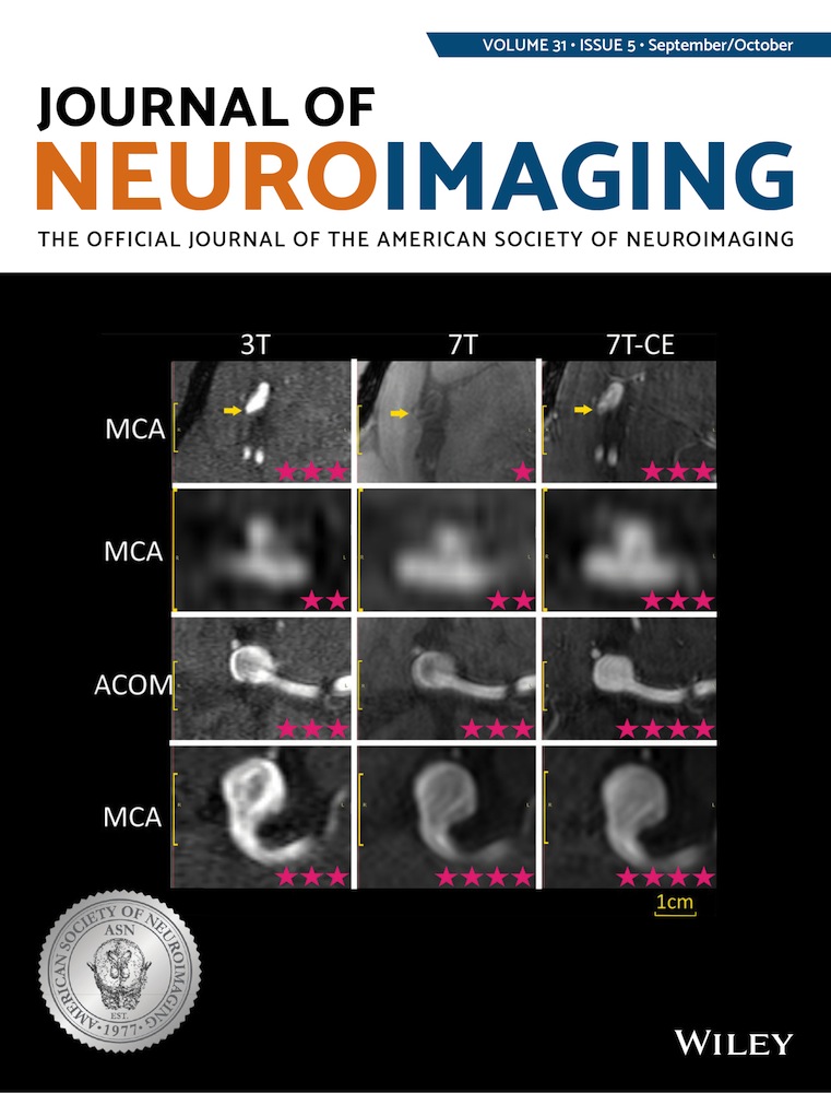 Machine learning to investigate superficial white matter integrity in early multiple sclerosis