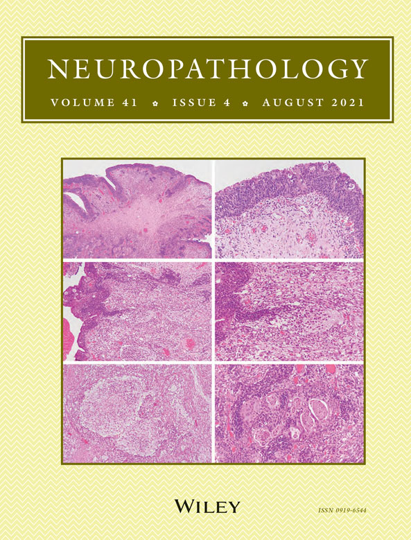 Spread of vimentin‐immunoreactive cells within the plaque‐like lesion in the spinal anterior horn of a patient with post‐poliomyelitis syndrome