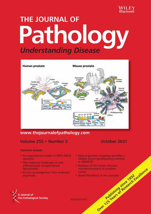 Weakly supervised annotation‐free cancer detection and prediction of genotype in routine histopathology