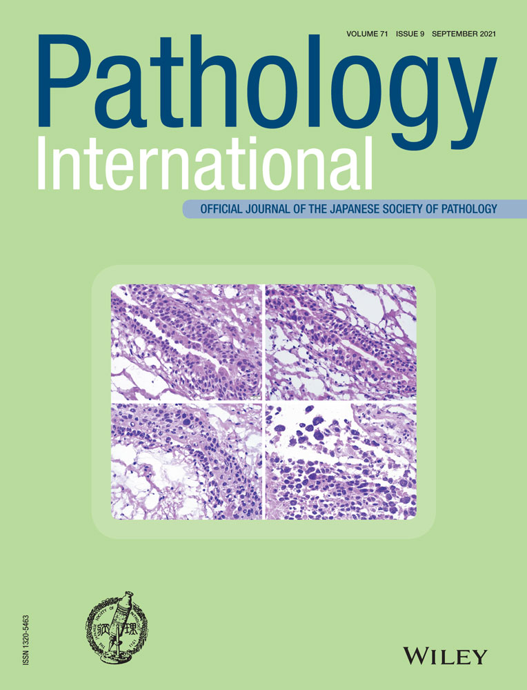 A primary thymic adenocarcinoma with two components that traced distinct evolutionary trajectories