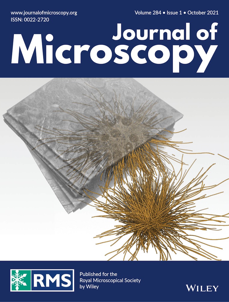 Local Kikuchi band detection in electron backscatter diffraction patterns for enhanced pattern indexing