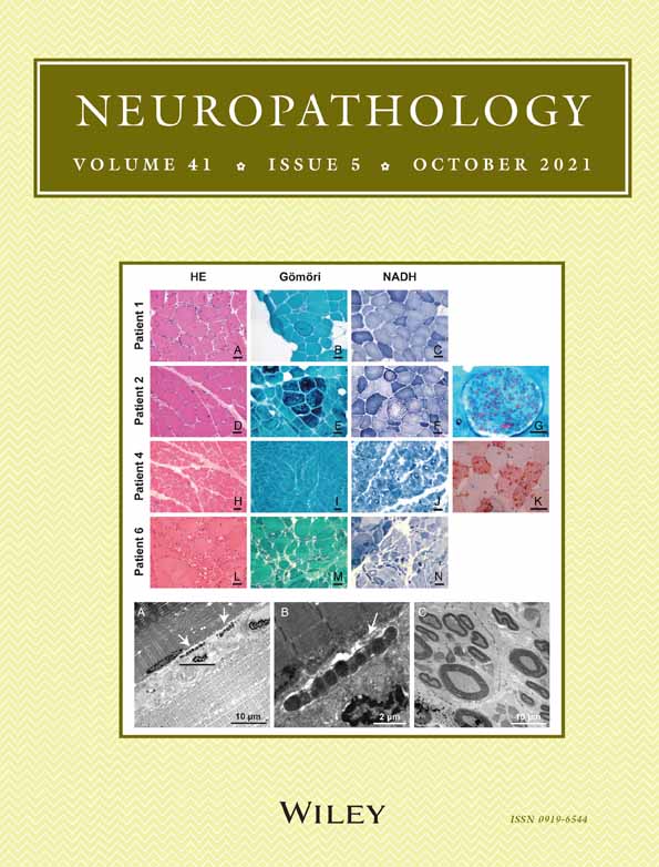 Lewy pathology of the submandibular gland in Lewy body disease: A report of autopsy cases