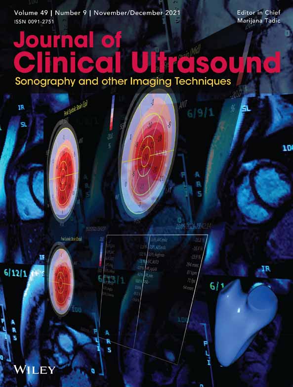 Sub‐pulmonic stenosis caused by a right ventricular outflow tract vegetation in a children with restricted ventricular septal defect