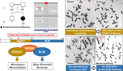 A SPIDR homozygous nonsense pathogenic variant in isolated primary ovarian insufficiency with chromosomal instability