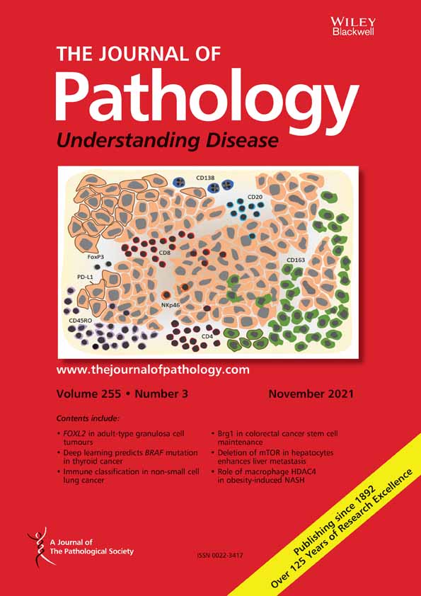 Mitochondria govern histone acetylation in colorectal cancer