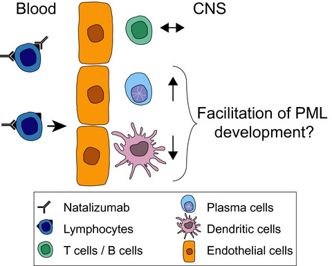 CNS inflammation after natalizumab therapy for multiple sclerosis: A retrospective histopathological and CSF cohort study