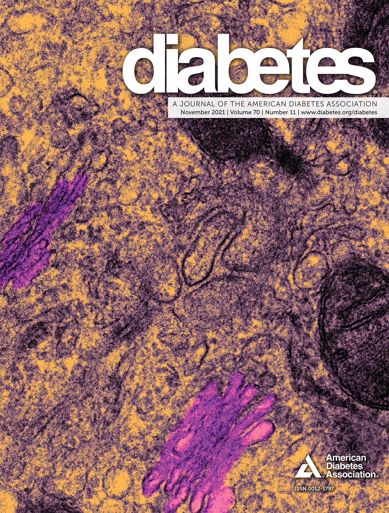 Treatment of Type 2 Diabetes and Obesity on the Basis of the Incretin System: The 2021 Banting Medal for Scientific Achievement Award Lecture