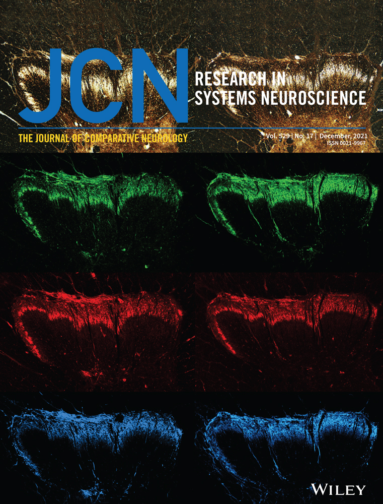 Nuclear Factor I in neurons, glia and during the formation of Müller glia‐derived progenitor cells in avian, porcine and primate retinas