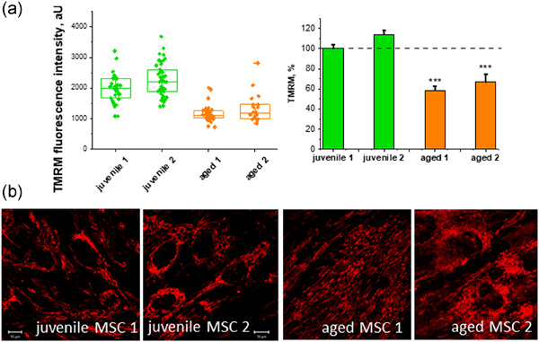 Age‐related changes in the energy of human mesenchymal stem cells