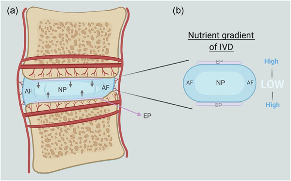 Role of autophagy in intervertebral disc degeneration