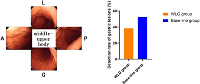 Feasibility of standardized procedures of white light gastroscopy for clinical practice: A multicenter study in China