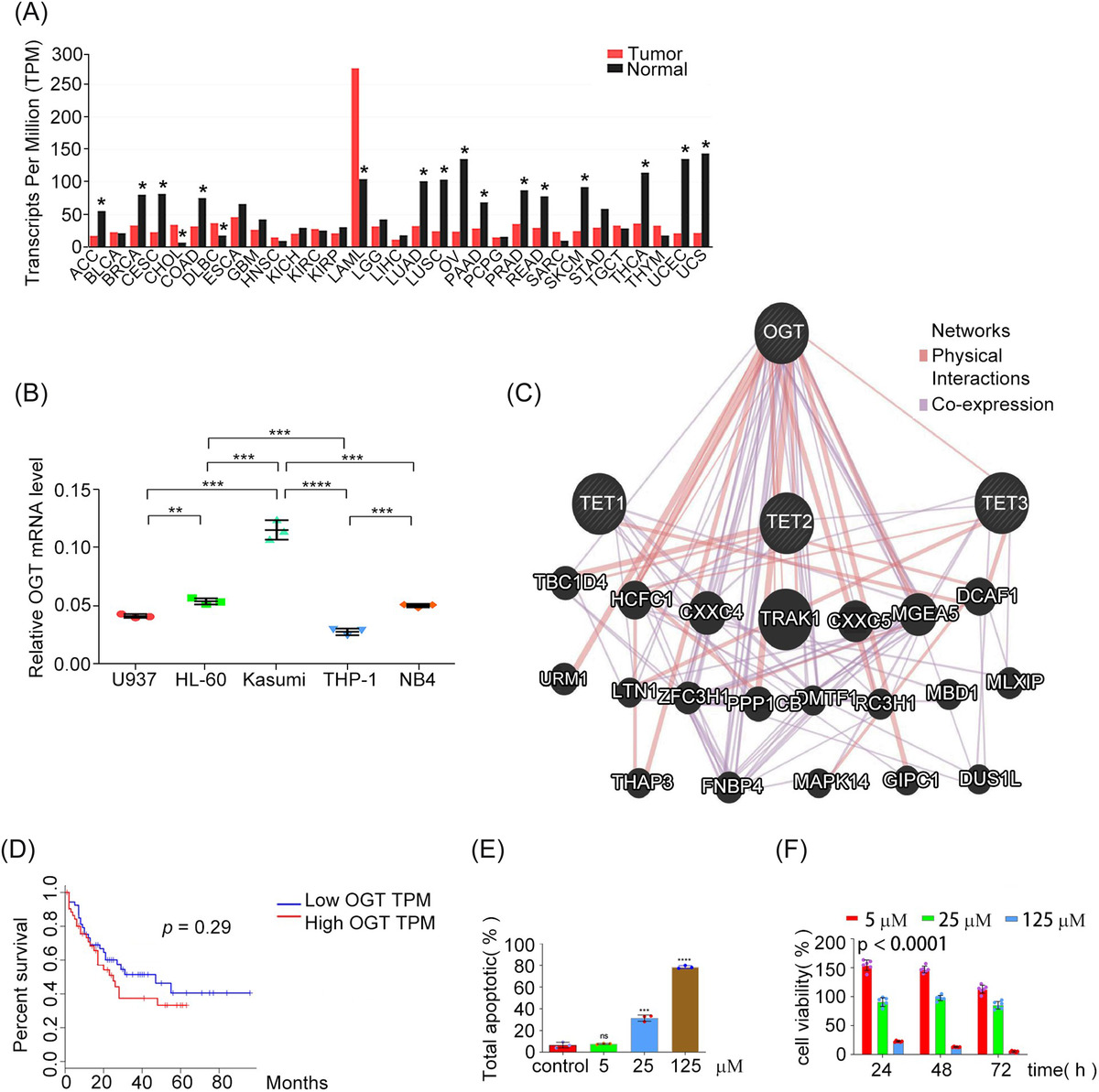 Upregulation of O‐GlcNAc transferase is involved in the pathogenesis of acute myeloid leukemia