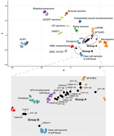 Intracranial mesenchymal tumors with FET‐CREB fusion are composed of at least two epigenetic subgroups distinct from meningioma and extracranial sarcomas