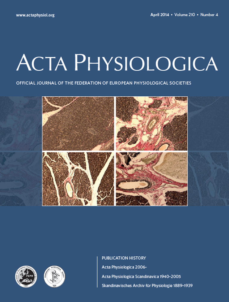 Sex differences in human fatigability: mechanisms and insight to physiological responses