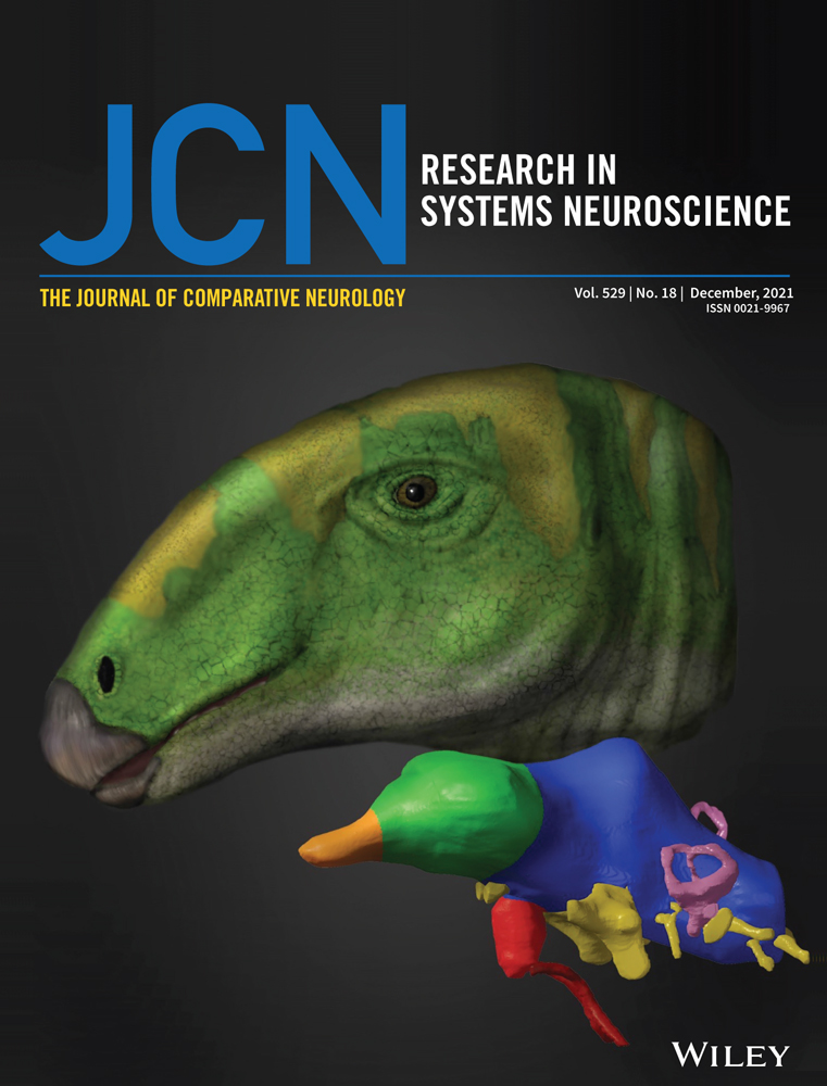 Structural changes in the neocortex as correlates of variations in EEG spectra and seizure susceptibility in rat brains with different degrees of dysplasia