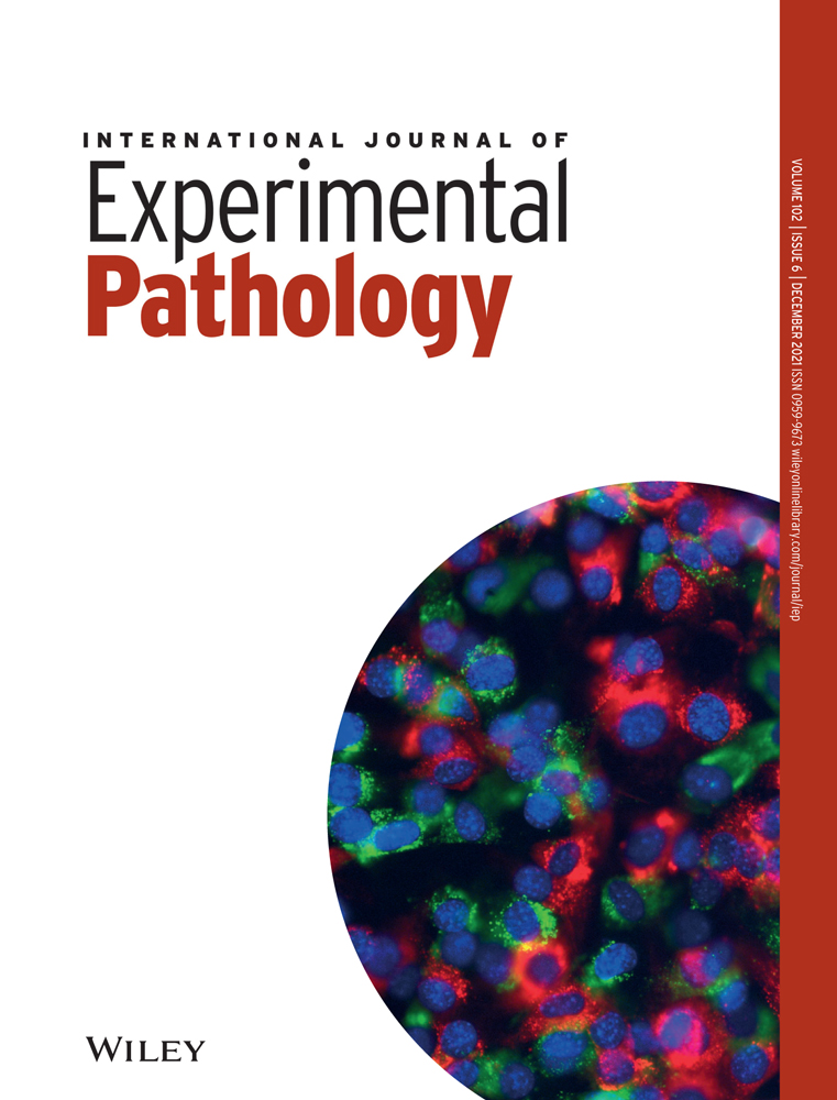 The role of caveolin‐1 and endothelial nitric oxide synthase polymorphisms in susceptibility to prostate cancer