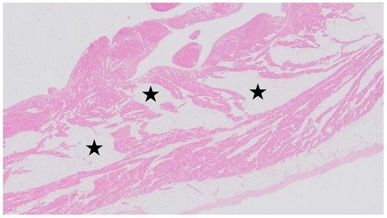 Cardiogenetics, Vol. 11, Pages 68-72: Genetic Diagnosis in Sudden Cardiac Death: The Crucial Role of Multidisciplinary Care