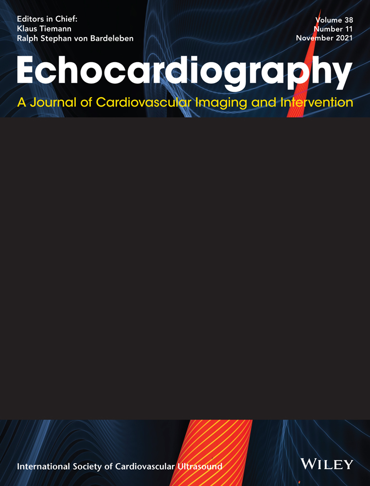 Bi‐atrial thrombus straddling a patent foramen ovale with bilateral embolization: A therapeutic challenge