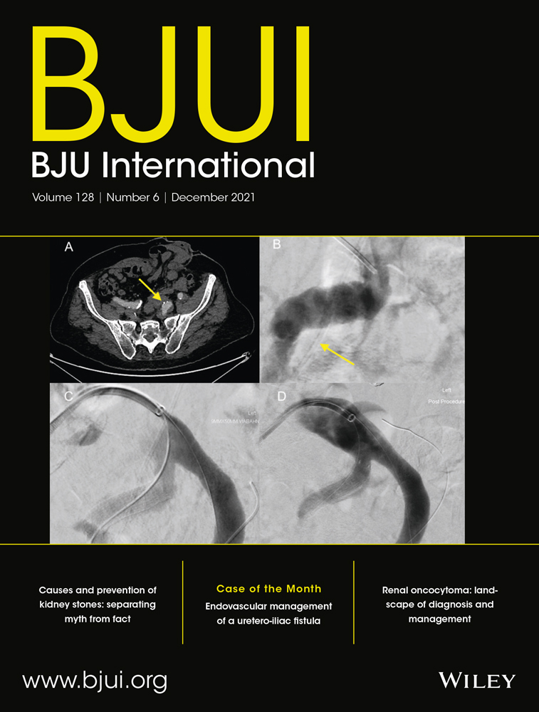 Feasibility and safety of radical prostatectomy for oligo‐metastatic prostate cancer: TRoMbone trial