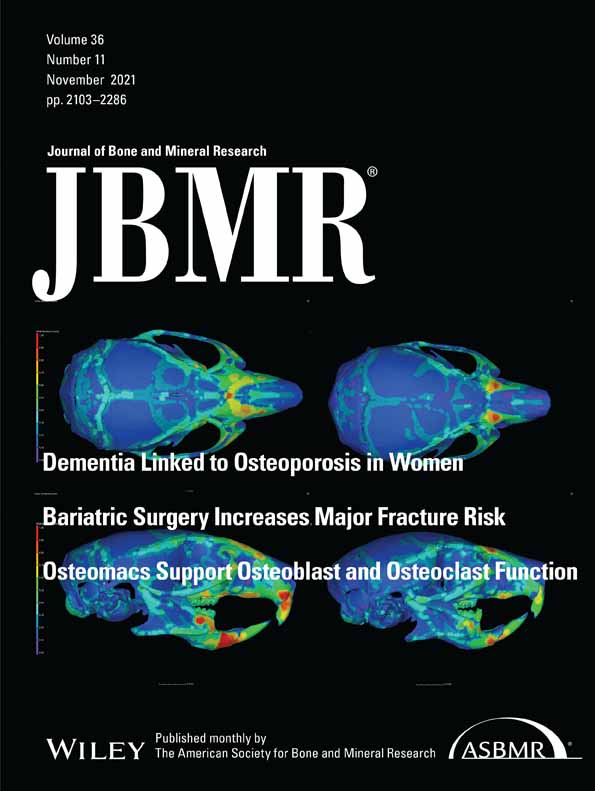 Musculoskeletal comorbidities and quality of life in ENPP1‐deficient adults and the response of enthesopathy to enzyme replacement therapy in murine models