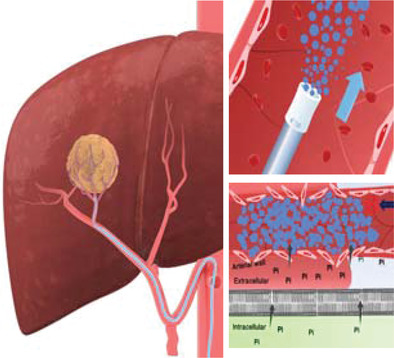 Low Inorganic Phosphate Stress Inhibits Liver Cancer Progression: from In Vivo to In Vitro