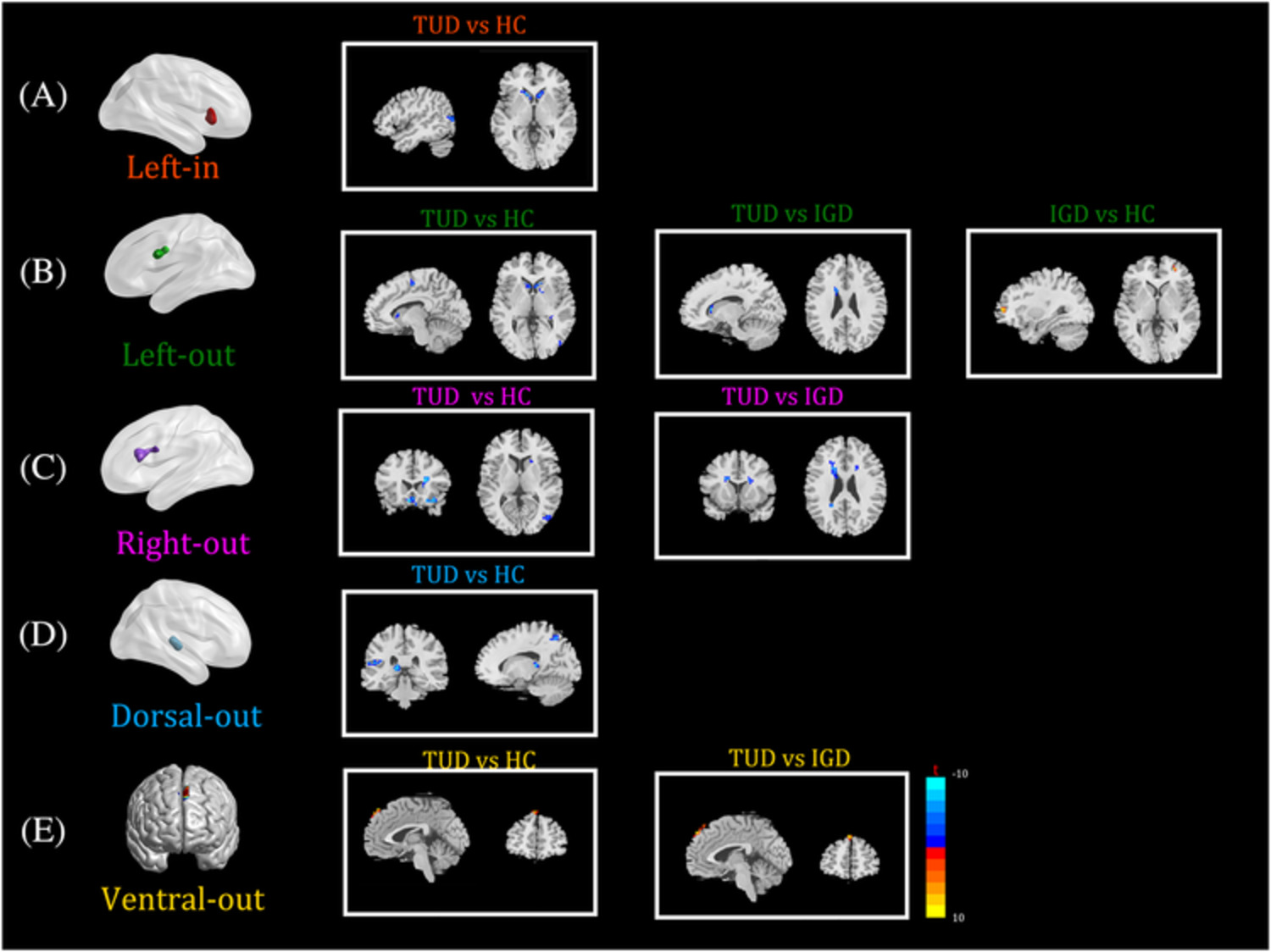 Similarities and differences between internet gaming disorder and tobacco use disorder: A large‐scale network study