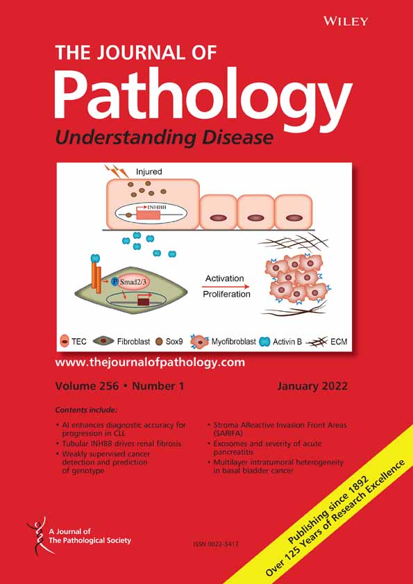 Quantitative features to assist in the diagnostic assessment of Chronic Lymphocytic Leukemia progression†