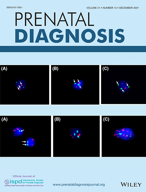 Trio exome sequencing is highly relevant in prenatal diagnostics