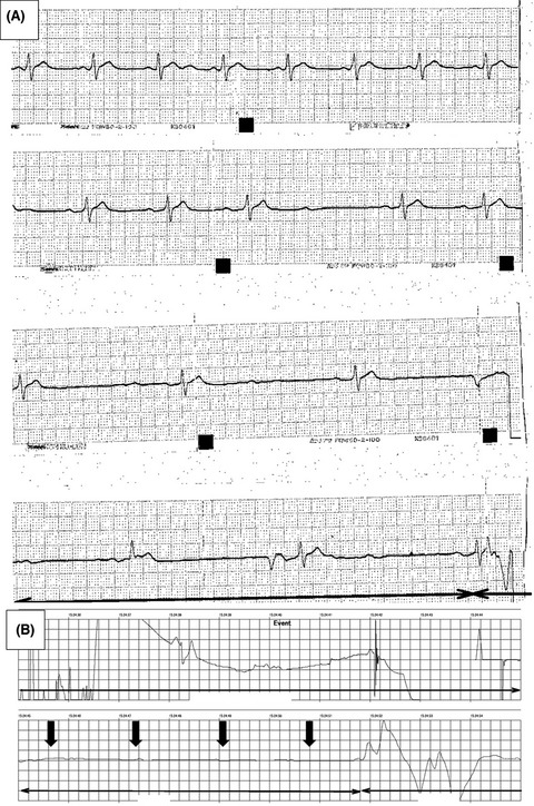 Cardiac arrest due to liquid nicotine intoxication: a case report