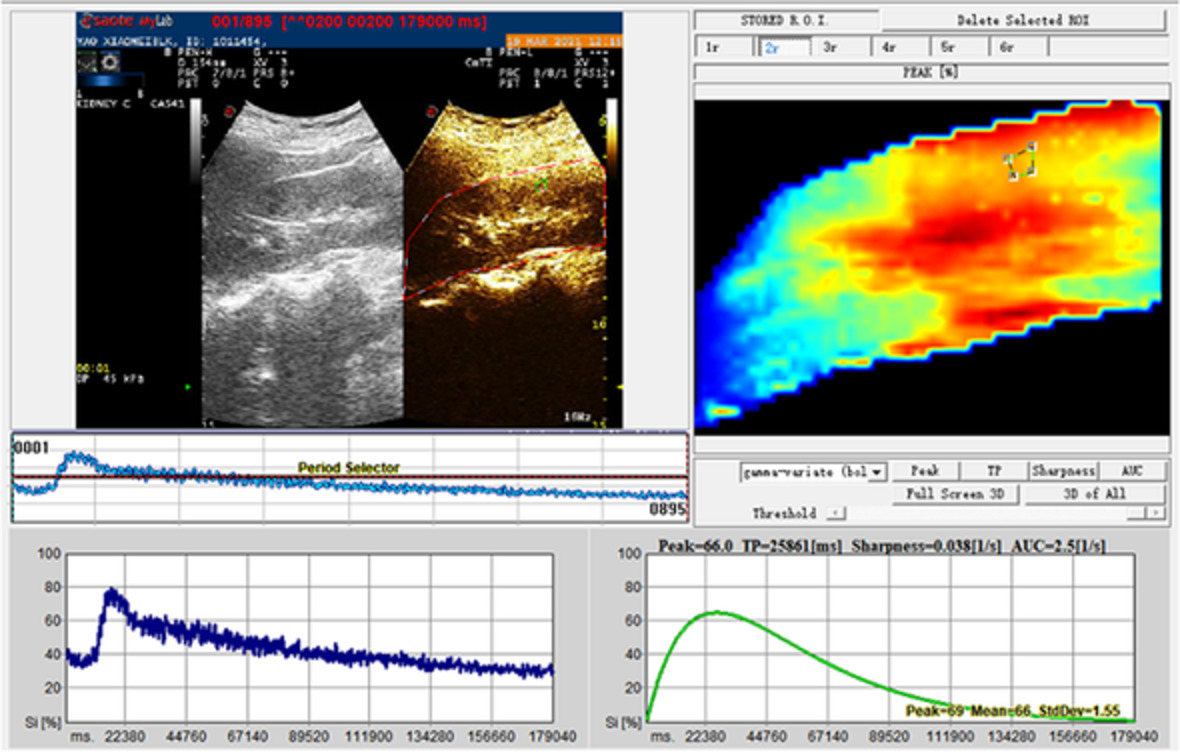 Diagnostic value of ultrasound and contrast‐enhanced ultrasound in septic acute kidney injury