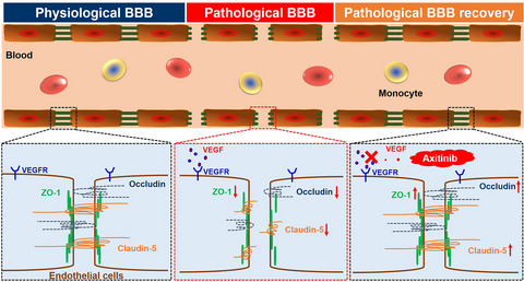 Effect of axitinib regulating the pathological blood–brain barrier functional recovery for glioblastoma therapeutics