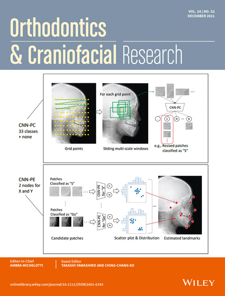 Low birth weight and occlusal traitsin the primary dentition a prospective cohort (BRISA)