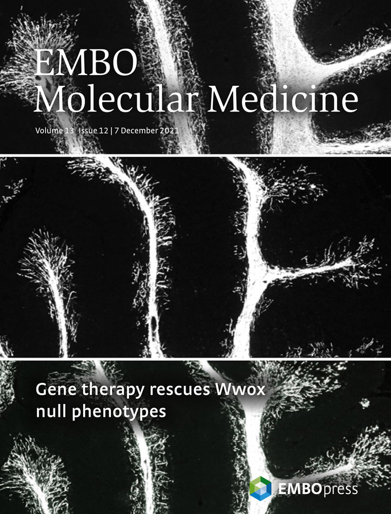 Decreased memory B cells frequencies in COVID‐19 Delta variant vaccine breakthrough infection