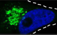 USP17 is required for peripheral trafficking of lysosomes