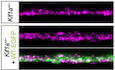 A neuropathy‐associated kinesin KIF1A mutation hyper‐stabilizes the motor‐neck interaction during the ATPase cycle